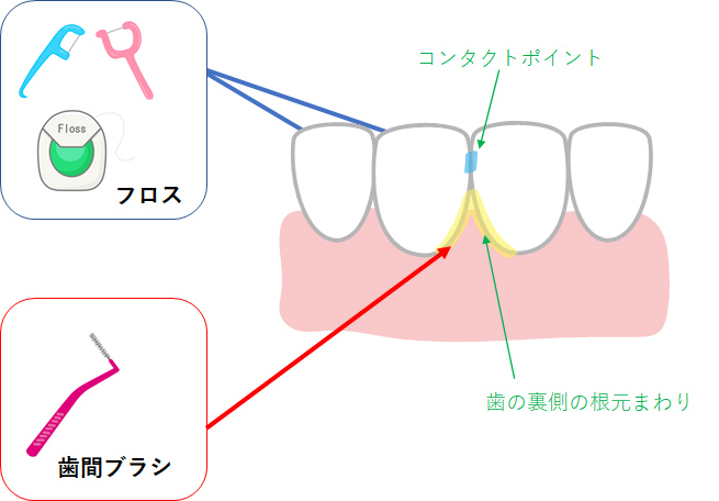 磨きにくい場所